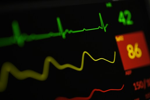 A close-up view of a digital medical monitor displaying vital signs including a green electrocardiogram (ECG) line, a yellow respiratory rate line, and numerical values with a red background indicating a concerning level.