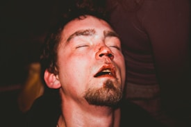 A man with a closed expression and visible bruises on his face, particularly around the nose and lips, suggesting injury or distress.