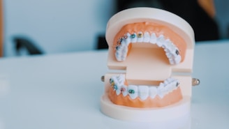 A dental model displaying orthodontic braces on both the top and bottom sets of teeth. The model rests on a glossy white surface, and various colored brackets are visible on the braces. The background is blurred, suggesting a clinical setting.
