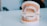 A dental model displaying orthodontic braces on both the top and bottom sets of teeth. The model rests on a glossy white surface, and various colored brackets are visible on the braces. The background is blurred, suggesting a clinical setting.