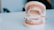 A dental model displaying orthodontic braces on both the top and bottom sets of teeth. The model rests on a glossy white surface, and various colored brackets are visible on the braces. The background is blurred, suggesting a clinical setting.