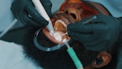A close-up view of a dental procedure taking place, showing a patient lying with their mouth open. The patient is wearing protective eyewear, and two hands wearing black gloves are holding dental instruments inside the patient's mouth.