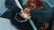 A close-up view of a dental procedure taking place, showing a patient lying with their mouth open. The patient is wearing protective eyewear, and two hands wearing black gloves are holding dental instruments inside the patient's mouth.