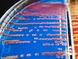 Petri dish containing a series of bacterial colonies spread across a nutrient agar. The dish is divided into sections, one with a blue hue and another with a red hue. The colonies vary in size and shape, spreading in linear patterns.