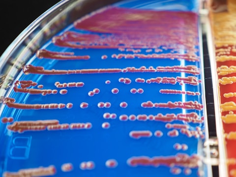 Petri dish containing a series of bacterial colonies spread across a nutrient agar. The dish is divided into sections, one with a blue hue and another with a red hue. The colonies vary in size and shape, spreading in linear patterns.