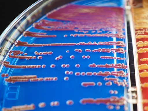 Petri dish containing a series of bacterial colonies spread across a nutrient agar. The dish is divided into sections, one with a blue hue and another with a red hue. The colonies vary in size and shape, spreading in linear patterns.