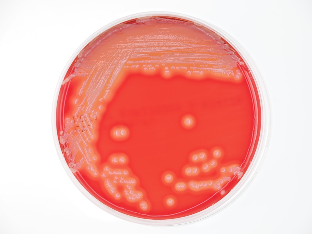 a close up of a red substance in a petri dish