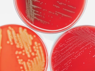 Three petri dishes filled with red agar medium, showing bacterial colonies of varying sizes and densities. The colonies appear as small, round dots or clusters on the surface of the agar.