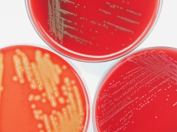 Three petri dishes filled with red agar medium, showing bacterial colonies of varying sizes and densities. The colonies appear as small, round dots or clusters on the surface of the agar.