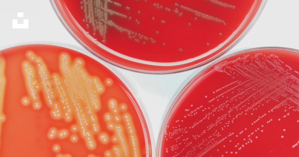 Un gros plan de trois cercles rouges et jaunes photo – Image gratuite ...