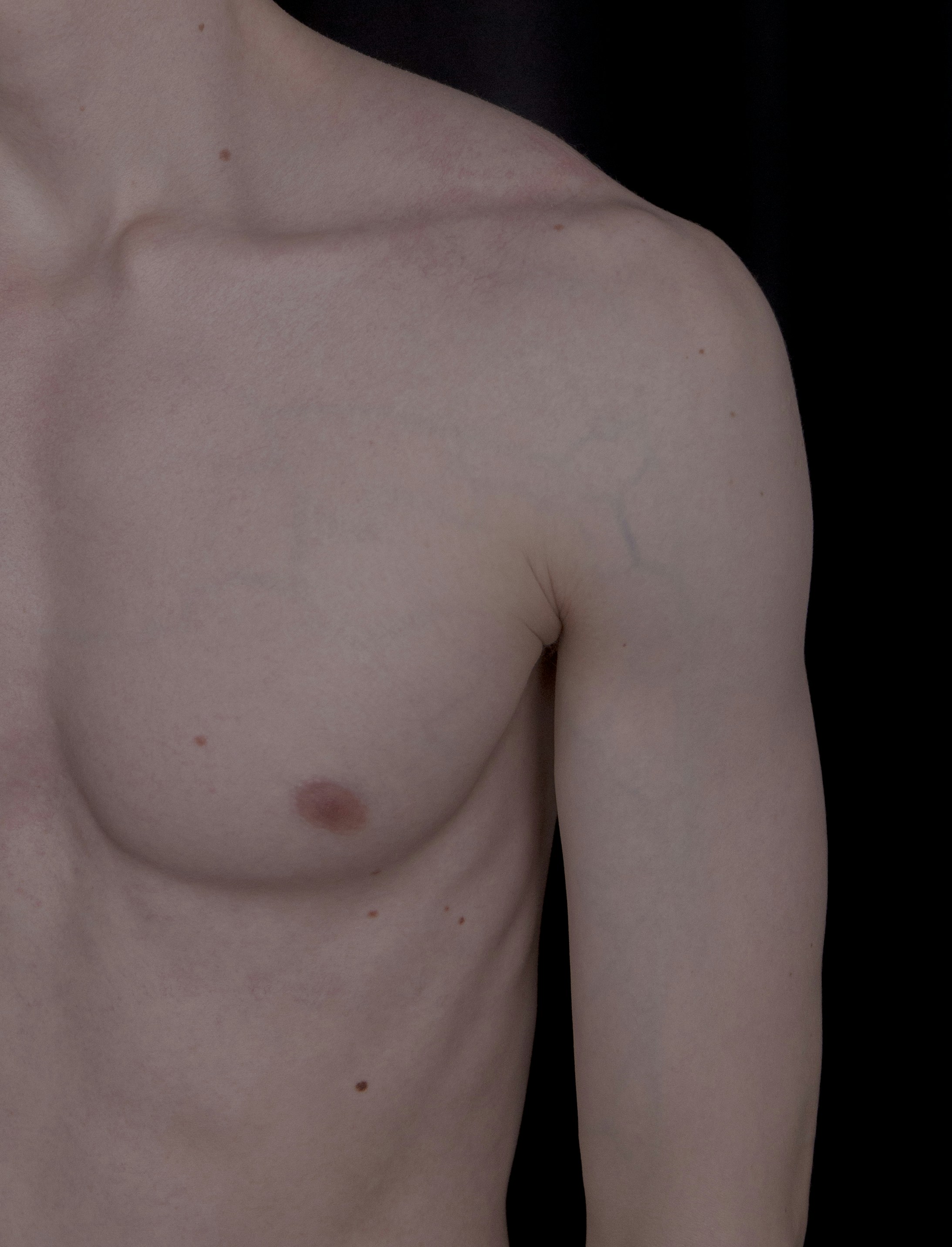 Male Nipples: A Developmental Leftover (image credits: unsplash)
