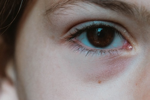 A close-up of a human eye with a focus on the details of the iris and surrounding skin. The image captures the texture of the skin, eyelashes, and the reflection in the eye.