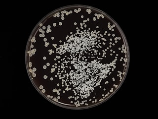 Colonies of microorganisms are scattered across a petri dish. The colonies vary in size but are mostly small and round. They create a dense clustering toward the center with more scattered formations around the edges.