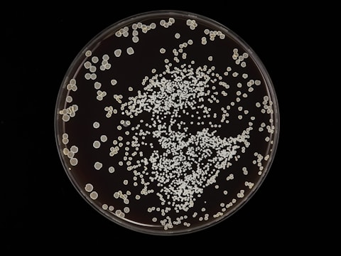 Colonies of microorganisms are scattered across a petri dish. The colonies vary in size but are mostly small and round. They create a dense clustering toward the center with more scattered formations around the edges.