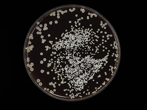 Colonies of microorganisms are scattered across a petri dish. The colonies vary in size but are mostly small and round. They create a dense clustering toward the center with more scattered formations around the edges.