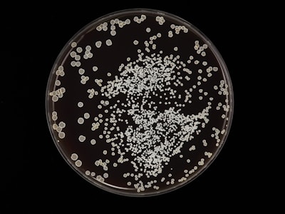 Colonies of microorganisms are scattered across a petri dish. The colonies vary in size but are mostly small and round. They create a dense clustering toward the center with more scattered formations around the edges.