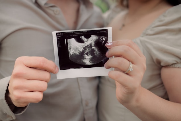 Two people holding a printed ultrasound image together, each using one hand. The ultrasound image is black and white, indicating a medical scan, possibly of a fetus. The individuals are wearing light-colored clothing, and one of them has a ring on their finger.