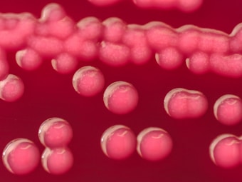 Several round, pink colonies, typical of bacterial growth, appear on a reddish agar surface, showcasing smooth, shiny surfaces.