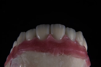 a close up of a tooth with gumpaste on it