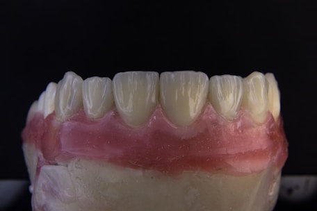 a close up of a tooth with gumpaste on it