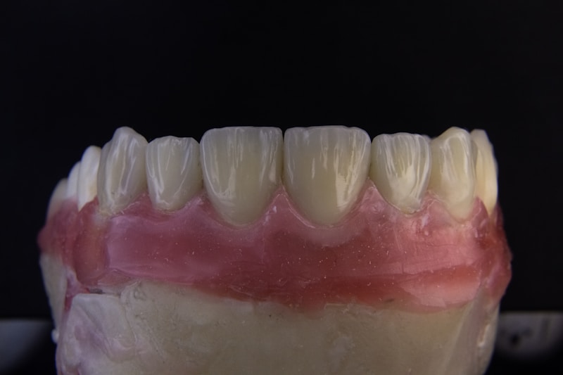 Geriatric Implantology.
