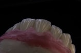 A close-up view of a set of artificial teeth, likely a dental model or prosthetic, with detailed textures visible on the tooth surfaces. The background is completely black, highlighting the white and pink hues of the model.