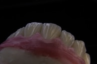 A close-up view of a set of artificial teeth, likely a dental model or prosthetic, with detailed textures visible on the tooth surfaces. The background is completely black, highlighting the white and pink hues of the model.