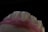 A close-up view of a set of artificial teeth, likely a dental model or prosthetic, with detailed textures visible on the tooth surfaces. The background is completely black, highlighting the white and pink hues of the model.