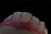 A close-up view of a set of artificial teeth, likely a dental model or prosthetic, with detailed textures visible on the tooth surfaces. The background is completely black, highlighting the white and pink hues of the model.
