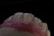 A close-up view of a set of artificial teeth, likely a dental model or prosthetic, with detailed textures visible on the tooth surfaces. The background is completely black, highlighting the white and pink hues of the model.