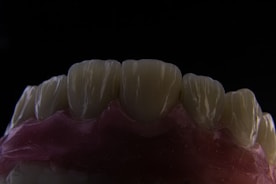 A close-up view of a dental model showing the upper front teeth. The teeth are detailed, with visible grooves and a slightly translucent appearance. The gums are depicted in a pinkish color, contrasting with the dark background.