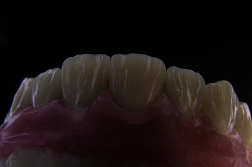 A close-up view of a dental model showing the upper front teeth. The teeth are detailed, with visible grooves and a slightly translucent appearance. The gums are depicted in a pinkish color, contrasting with the dark background.