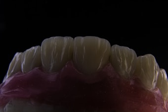 A close-up view of a dental model showing the upper front teeth. The teeth are detailed, with visible grooves and a slightly translucent appearance. The gums are depicted in a pinkish color, contrasting with the dark background.