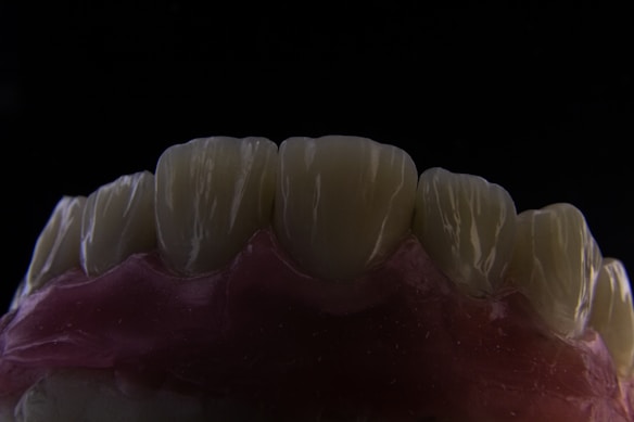A close-up view of a dental model showing the upper front teeth. The teeth are detailed, with visible grooves and a slightly translucent appearance. The gums are depicted in a pinkish color, contrasting with the dark background.