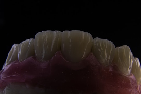 A close-up view of a dental model showing the upper front teeth. The teeth are detailed, with visible grooves and a slightly translucent appearance. The gums are depicted in a pinkish color, contrasting with the dark background.