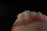 A close-up view of a dental model showing the upper front teeth and gum area, with a dark background emphasizing the detail and texture of the artificial teeth and gums.