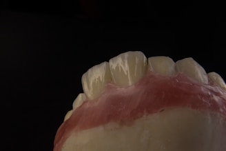 A close-up view of a dental model showing the upper front teeth and gum area, with a dark background emphasizing the detail and texture of the artificial teeth and gums.