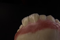 A close-up view of a dental model showing the upper front teeth and gum area, with a dark background emphasizing the detail and texture of the artificial teeth and gums.