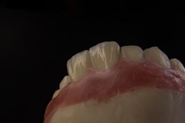 A close-up view of a dental model showing the upper front teeth and gum area, with a dark background emphasizing the detail and texture of the artificial teeth and gums.
