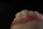 A close-up view of a dental model showing the upper front teeth and gum area, with a dark background emphasizing the detail and texture of the artificial teeth and gums.