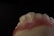 A close-up view of a dental model showing the upper front teeth and gum area, with a dark background emphasizing the detail and texture of the artificial teeth and gums.