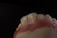 A close-up view of a dental model showing the upper front teeth and gum area, with a dark background emphasizing the detail and texture of the artificial teeth and gums.