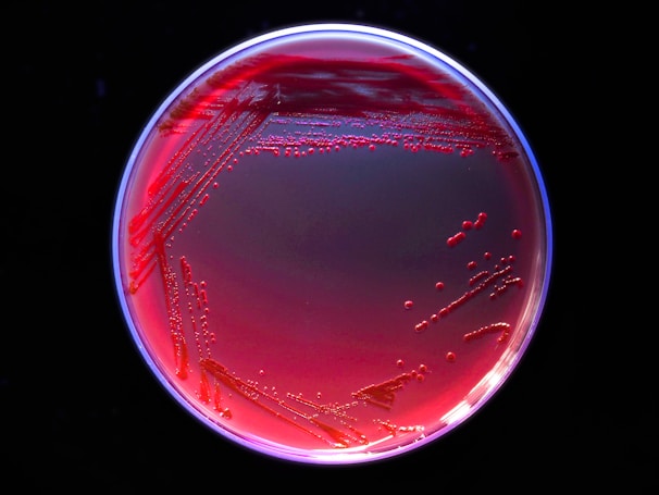 A petri dish containing red bacterial colonies on an agar surface. The colonies form scattered clusters and lines across the dish, highlighting varying growth patterns against a dark background.
