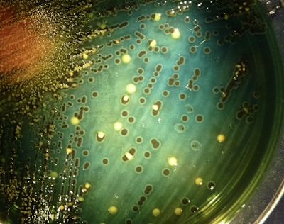Microscope view showing bacteria culture in a petri dish for microbiology testing.