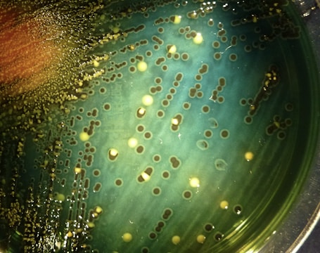 A petri dish filled with a greenish medium featuring numerous colonies of bacteria that range in color from yellow to brown. The colonies are circular and vary in size, with some concentrated more heavily in certain areas, indicating possible growth patterns or reactions. The surface has a glossy, wet appearance, suggesting it is freshly cultivated.