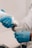 A person wearing blue gloves is applying a gel from a bottle onto a medical device, possibly an ultrasound probe, indicating preparation for a medical procedure.