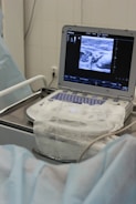 An ultrasound machine displaying an image on its screen is situated on a hospital trolley. The machine has a covered keyboard and several wires or cables attached. The setting appears to be a medical environment, likely a hospital or clinic, with a sterile and clinical appearance.
