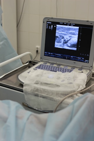 An ultrasound machine displaying an image on its screen is situated on a hospital trolley. The machine has a covered keyboard and several wires or cables attached. The setting appears to be a medical environment, likely a hospital or clinic, with a sterile and clinical appearance.
