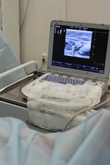 An ultrasound machine displaying an image on its screen is situated on a hospital trolley. The machine has a covered keyboard and several wires or cables attached. The setting appears to be a medical environment, likely a hospital or clinic, with a sterile and clinical appearance.