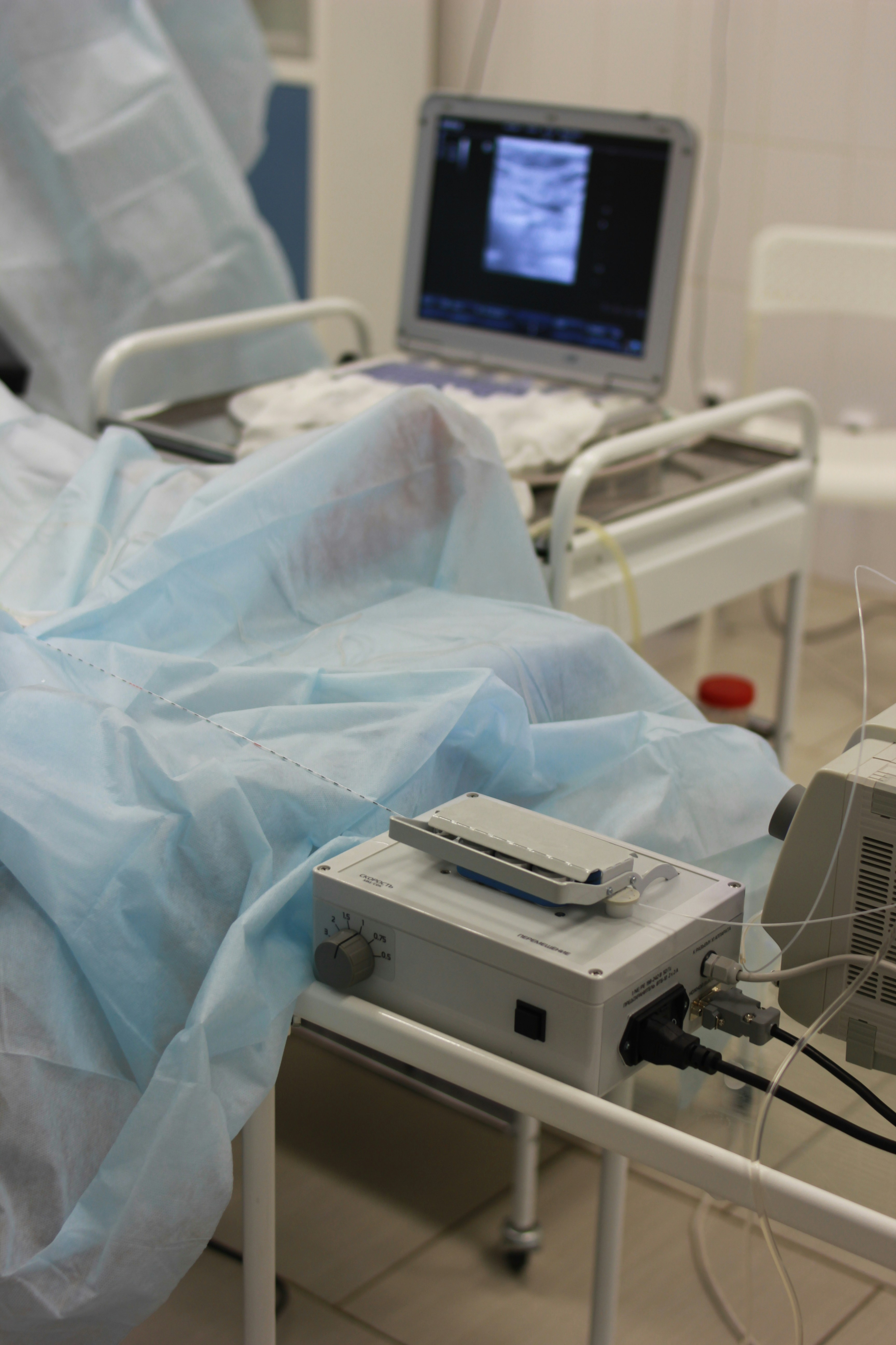 Patient receiving radio frequency microneedling treatment